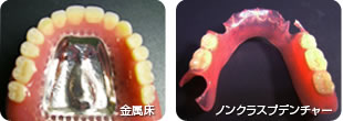 入れ歯